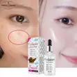 Aichun Beauty Collagen Deep Cleansing Snail Face Serum - 2