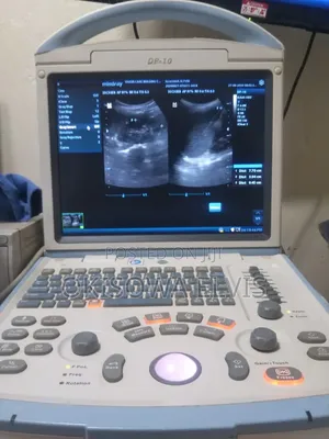 DP 10 Ultrasound Scan Machine