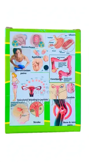 Ryanka 82 TZ Herbal Supplement for Ulcers, Infections, Joints & Muscles