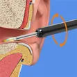 Wireless Visual Earpick with HD Camera - 3