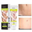 Stretch Marks Cream Moisturizer - 2