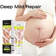 Stretch Marks Cream Moisturizer - 3
