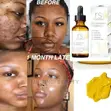 Roushun Naturals Vitamin C+ Skin Clearing Serum (30ml) - 2