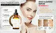Roushun Naturals Vitamin C+ Skin Clearing Serum (30ml) - 4
