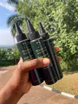 Hair Growth Oil - Stimulates Scalp & Revives Follicles - 5