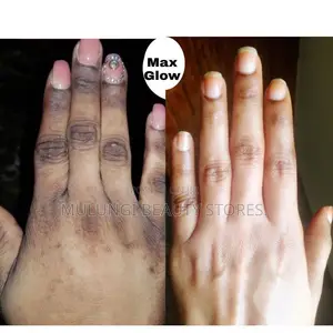 Knuckles & Black Spots Clarifying Cream (150g)