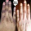 Knuckles & Black Spots Clarifying Cream (150g) - 4