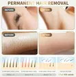 IPL Hair Removal Device - 500,000 Flashes - 2